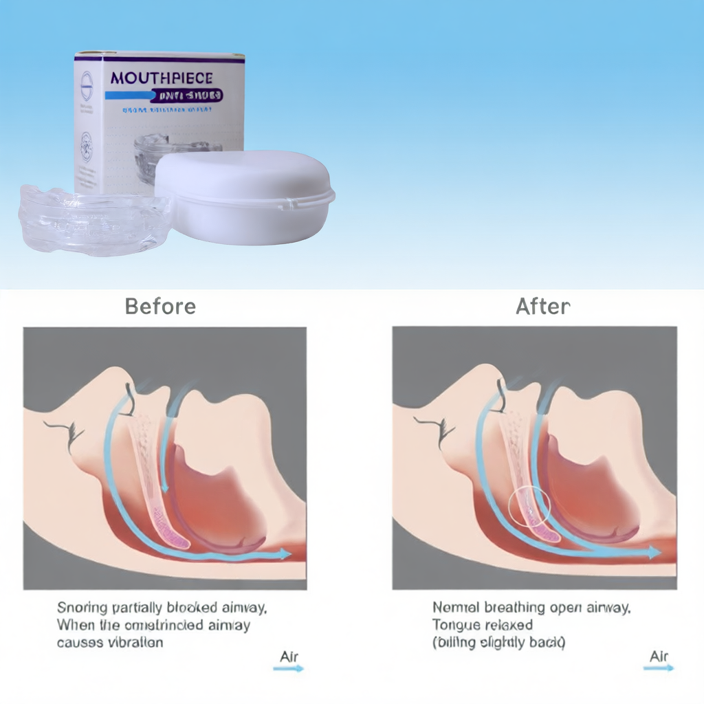 RestEasy Anti-Snoring Mouthpiece
